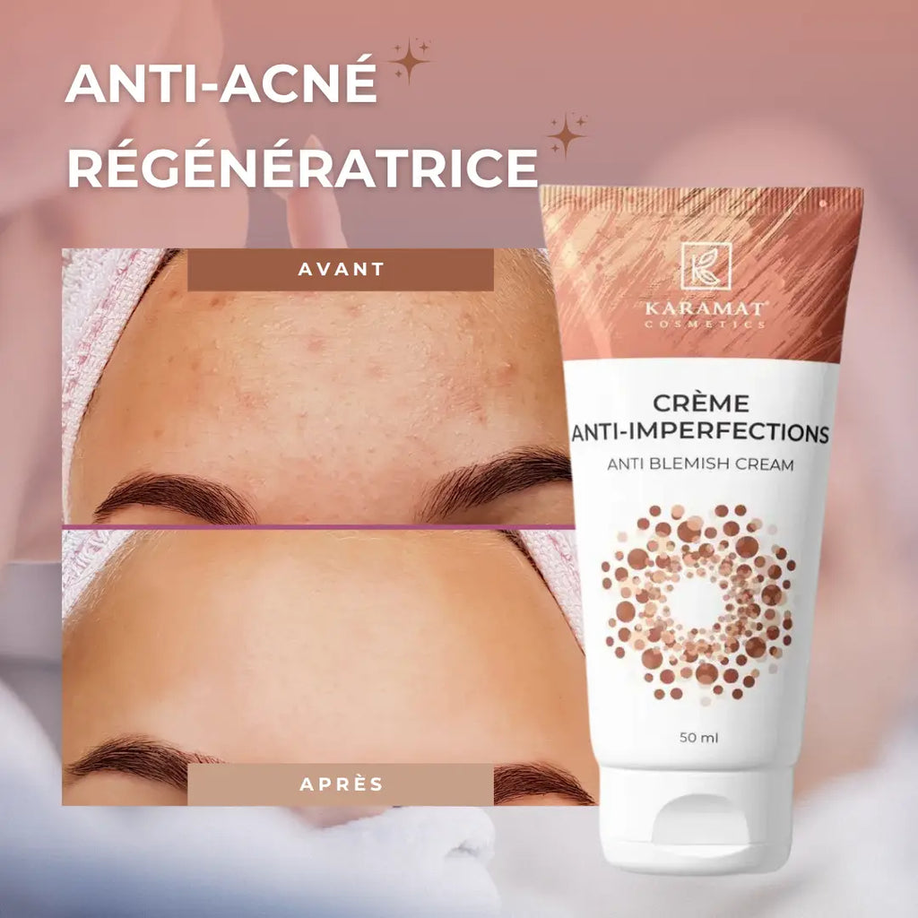 Crème anti – imperfections 50 ml